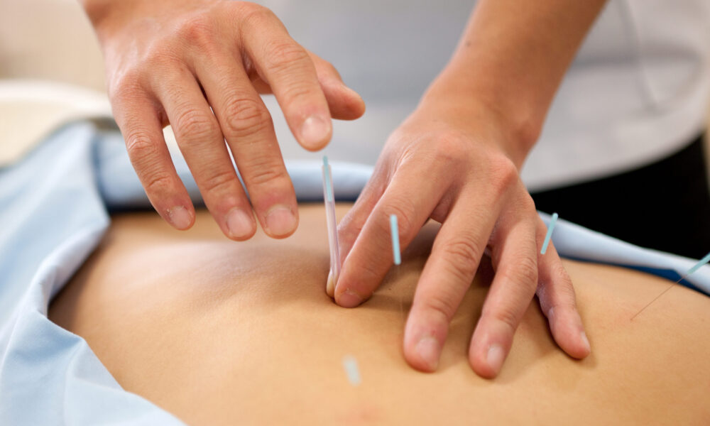 鍼灸・鍼治療 鍼灸・鍼治療